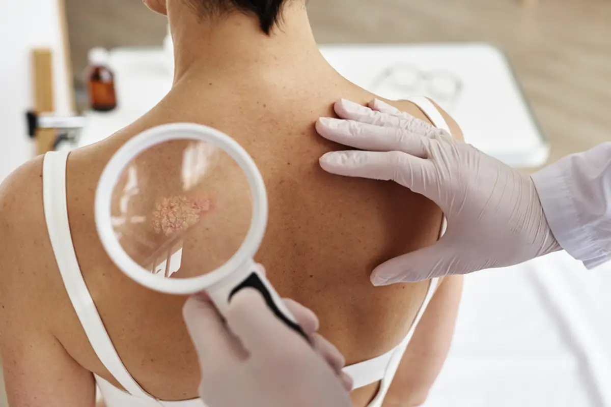 Landing Pages para Dermatologistas